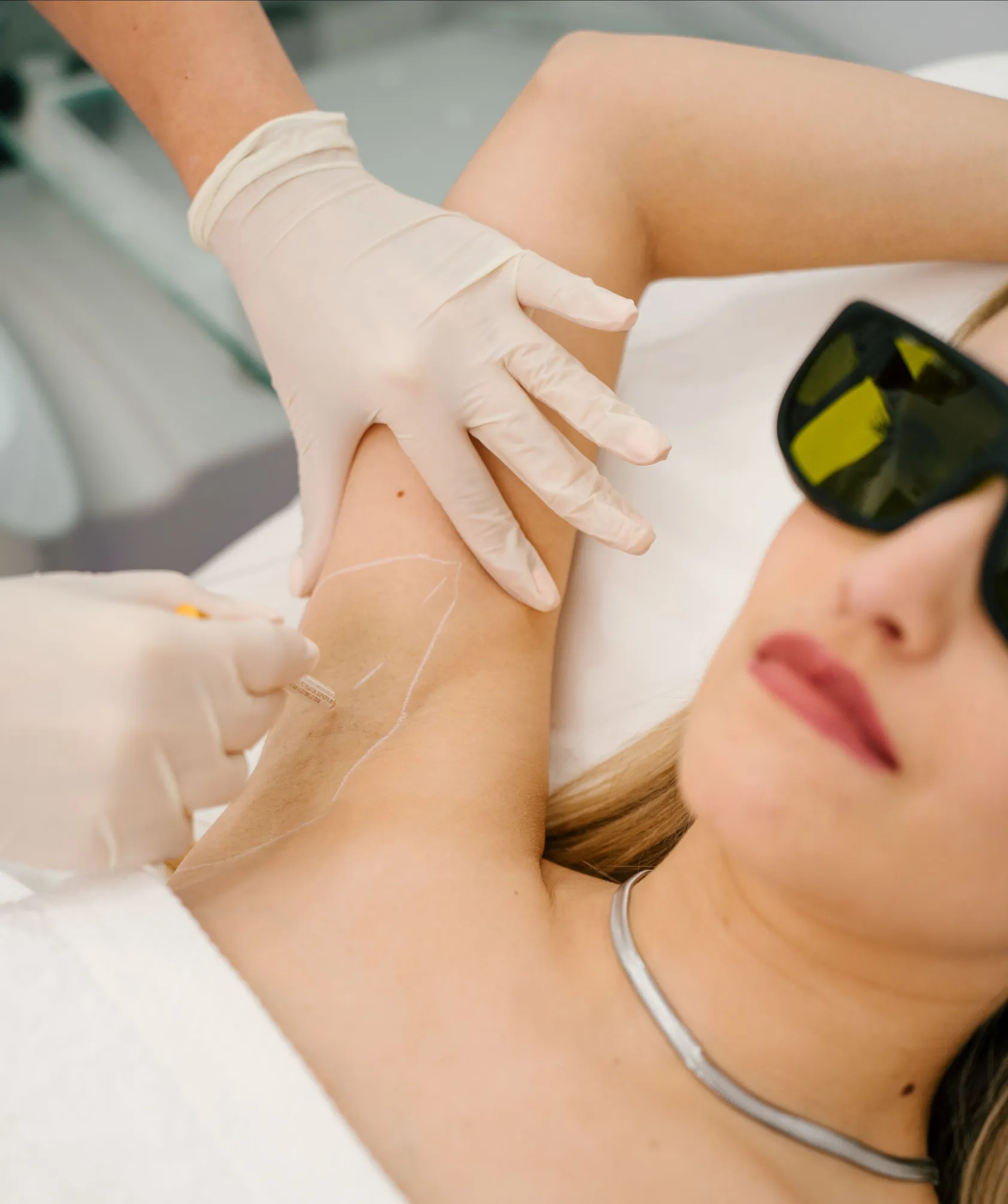Profissional da Depiderme a preparar a axila de uma cliente para depilação laser